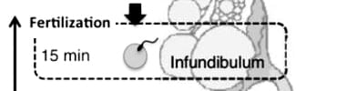 The infundibulum