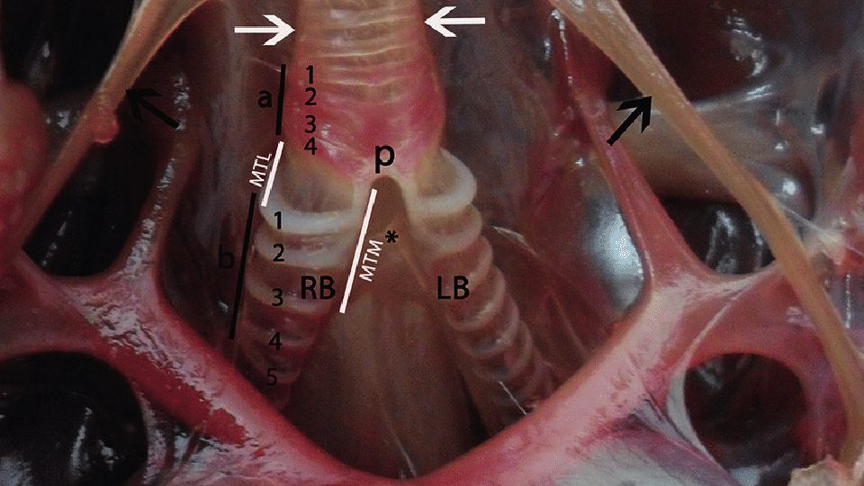 orsal view of syrinx, a1-a4: Cartilages of tracheosyringeal rings, a2-a4: Tympanum, b: Cartilages broncosyringeal rings, Black arrows: Sternotracheal muscle, White arrows: Tracheolateral muscle, MTM: Membrana tympaniformis medialis, MTL: Membrana tympaniformis lateralis, P: Pessulus, (*): Ligamentum interbronchiale, RB: Right bronchiole, LB: Left bronchiole, T: Trachea.